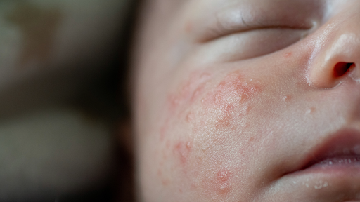 Skincare for Every Age