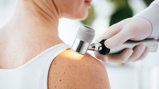 chronic skin conditions treatment